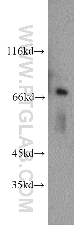 Western Blot (WB) analysis of MCF-7 cells using POLA2 Polyclonal antibody (21778-1-AP)