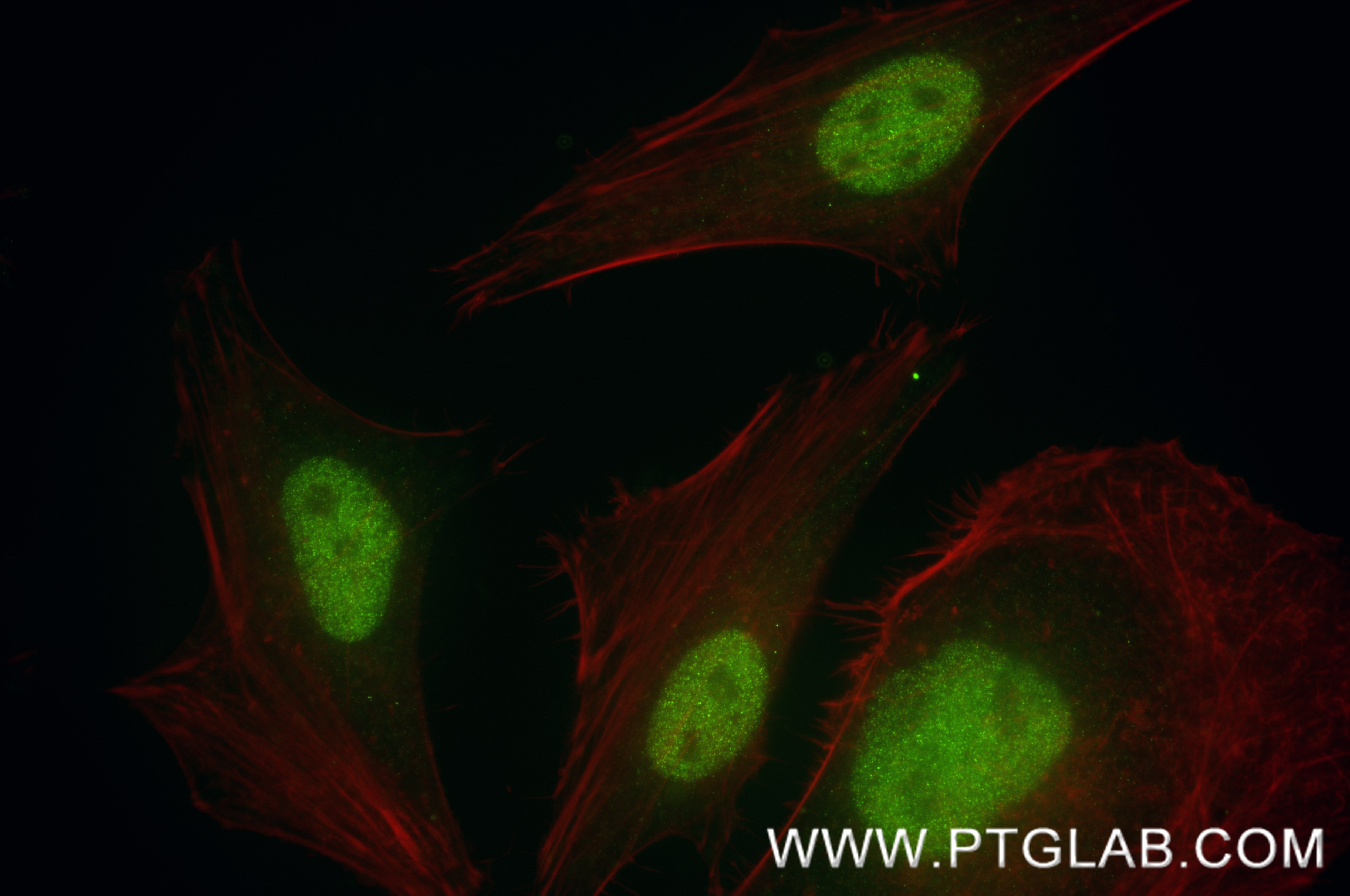 Immunofluorescence (IF) / fluorescent staining of HeLa cells using POLA2 Recombinant monoclonal antibody (86856-1-RR)