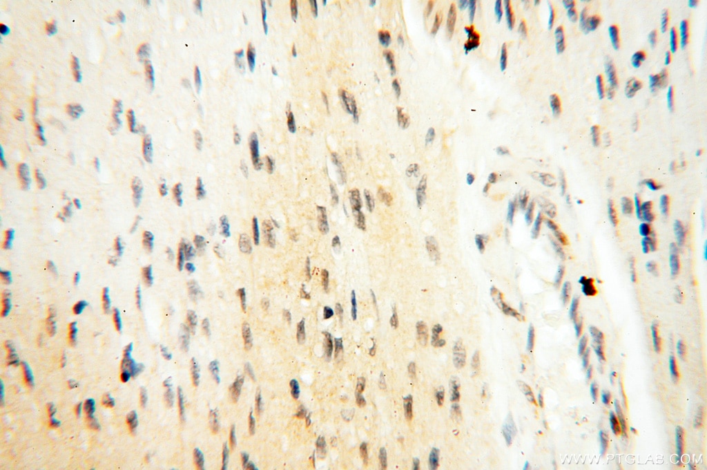 DNA Polymerase Beta