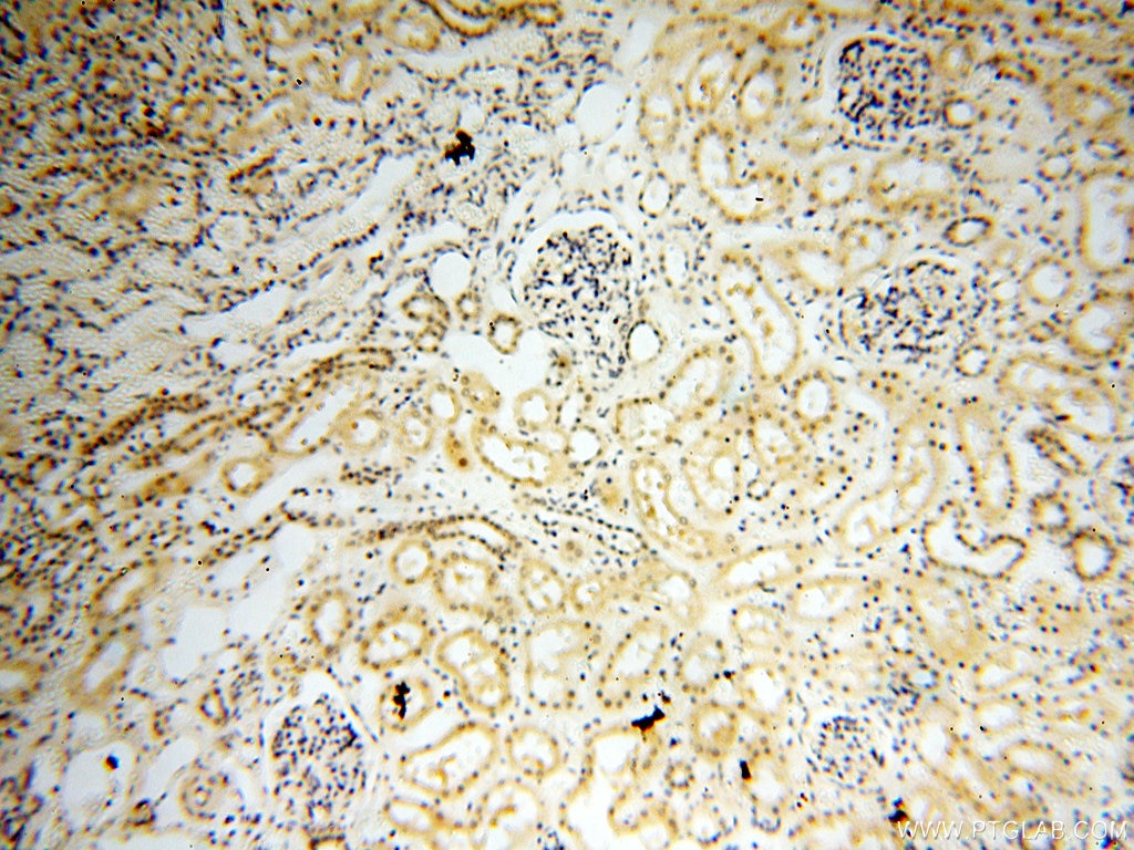 Immunohistochemistry (IHC) staining of human kidney tissue using DNA Polymerase Beta Polyclonal antibody (18003-1-AP)