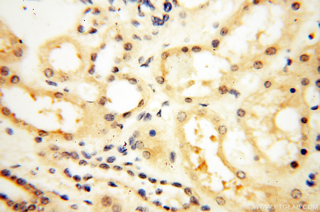 Immunohistochemistry (IHC) staining of human kidney tissue using DNA Polymerase Beta Polyclonal antibody (18003-1-AP)