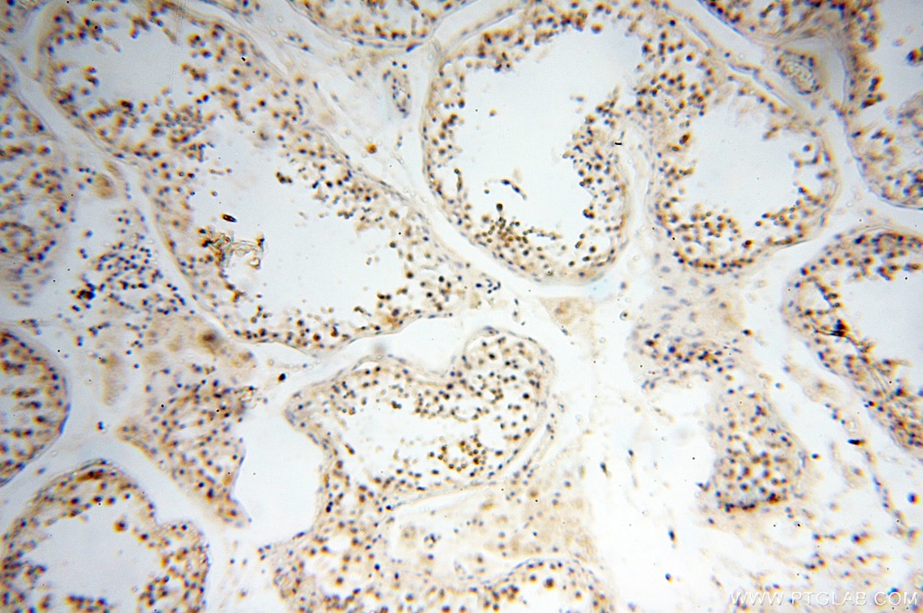Immunohistochemistry (IHC) staining of human testis tissue using DNA Polymerase Beta Polyclonal antibody (18003-1-AP)