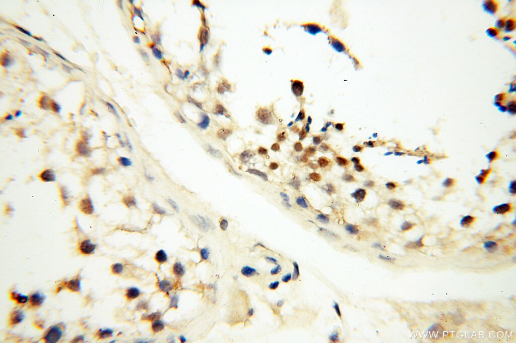 Immunohistochemistry (IHC) staining of human testis tissue using DNA Polymerase Beta Polyclonal antibody (18003-1-AP)