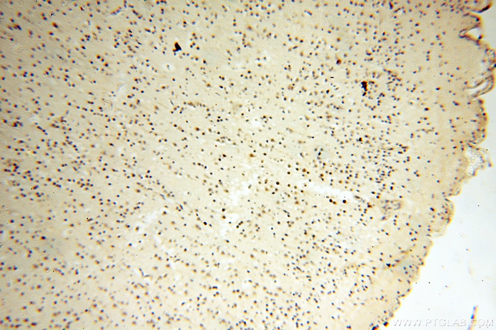 Immunohistochemistry (IHC) staining of human brain tissue using DNA Polymerase Beta Polyclonal antibody (18003-1-AP)