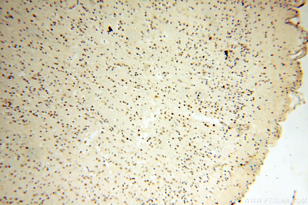 Immunohistochemistry (IHC) staining of human brain tissue using DNA Polymerase Beta Polyclonal antibody (18003-1-AP)