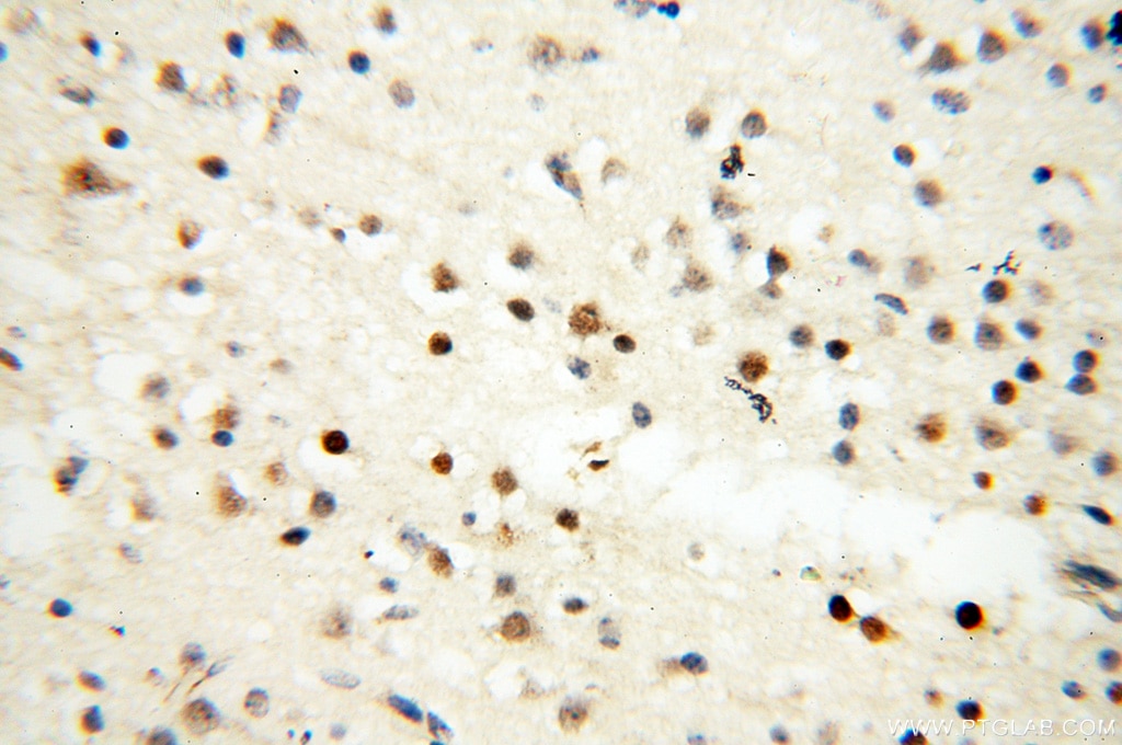 Immunohistochemistry (IHC) staining of human brain tissue using DNA Polymerase Beta Polyclonal antibody (18003-1-AP)