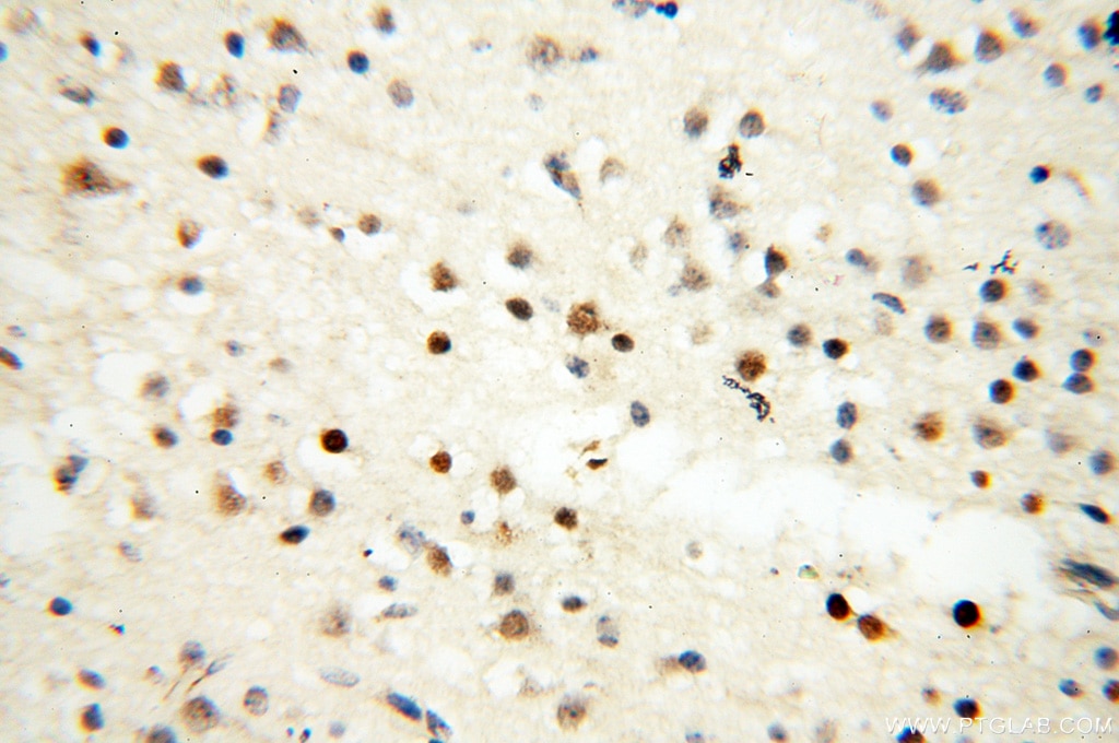 IHC staining of human brain using 18003-1-AP