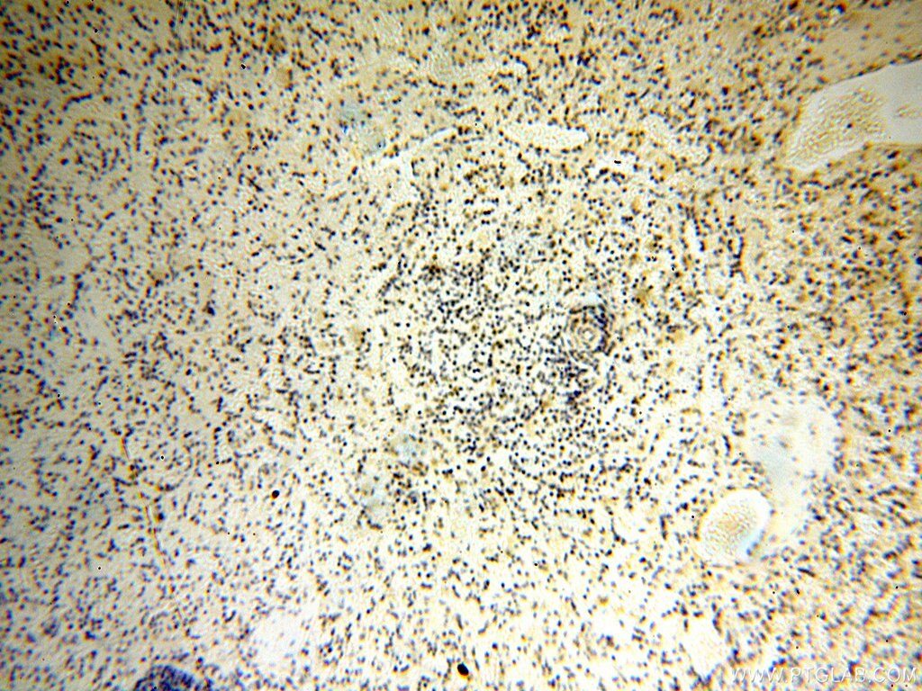 Immunohistochemistry (IHC) staining of human spleen tissue using DNA Polymerase Beta Polyclonal antibody (18003-1-AP)