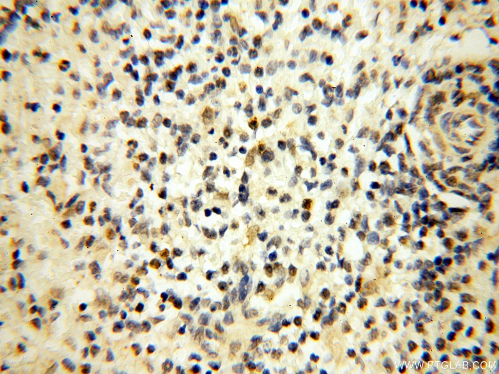 Immunohistochemistry (IHC) staining of human spleen tissue using DNA Polymerase Beta Polyclonal antibody (18003-1-AP)