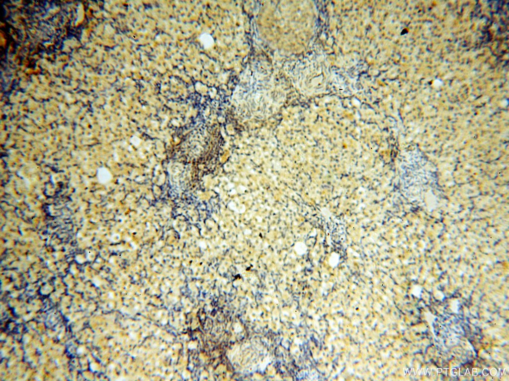 Immunohistochemistry (IHC) staining of human ovary tissue using DNA Polymerase Beta Polyclonal antibody (18003-1-AP)