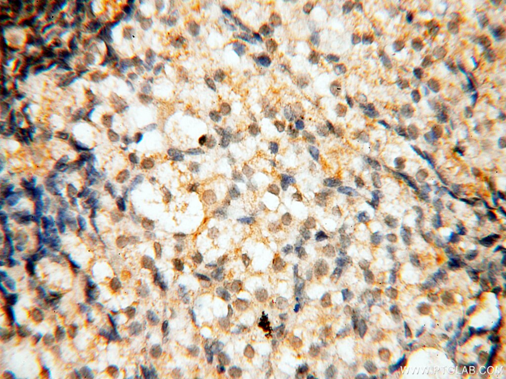 Immunohistochemistry (IHC) staining of human ovary tissue using DNA Polymerase Beta Polyclonal antibody (18003-1-AP)