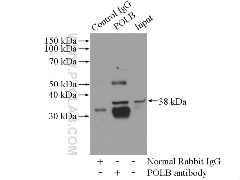 Immunoprecipitation (IP) experiment of K-562 cells using DNA Polymerase Beta Polyclonal antibody (18003-1-AP)