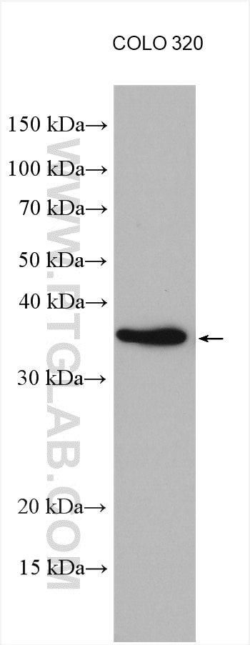 Western Blot (WB) analysis of various lysates using DNA Polymerase Beta Polyclonal antibody (18003-1-AP)