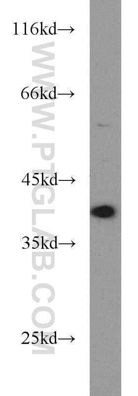 Western Blot (WB) analysis of K-562 cells using DNA Polymerase Beta Polyclonal antibody (18003-1-AP)
