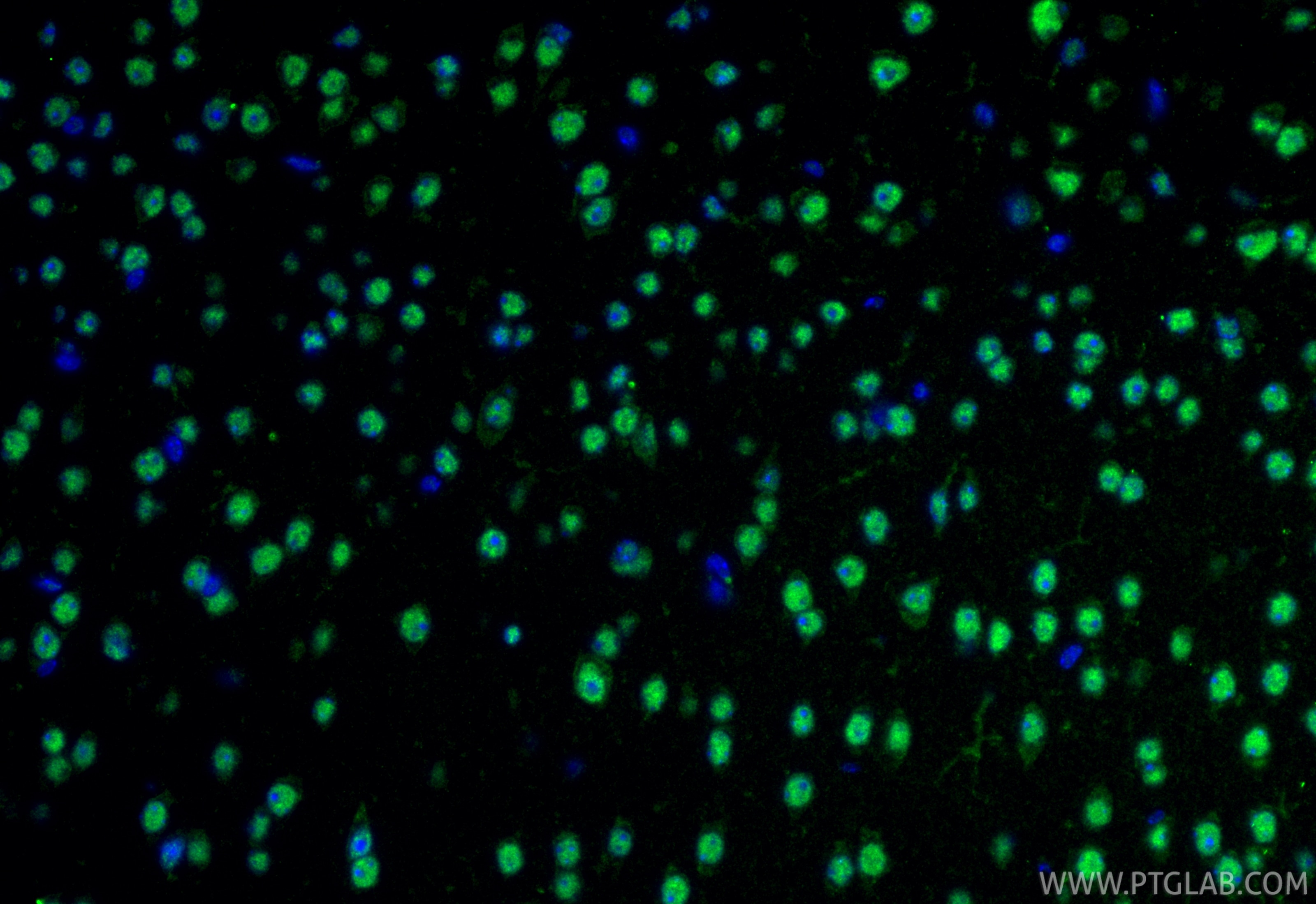 IF Staining of mouse brain using 86680-1-RR (same clone as 86680-1-PBS) Immunofluorescence (IF) / fluorescent staining of mouse brain tissue using POLB Recombinant monoclonal antibody (86680-1-RR)