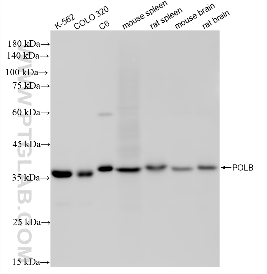WB analysis using 86680-1-RR (same clone as 86680-1-PBS) Western Blot (WB) analysis of various lysates using POLB Recombinant monoclonal antibody (86680-1-RR)