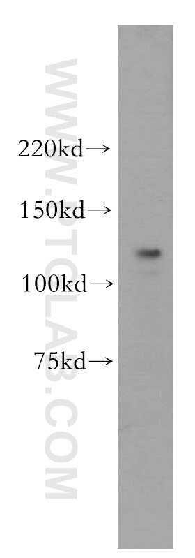 Western Blot (WB) analysis of HeLa cells using POLD1 Polyclonal antibody (15646-1-AP)