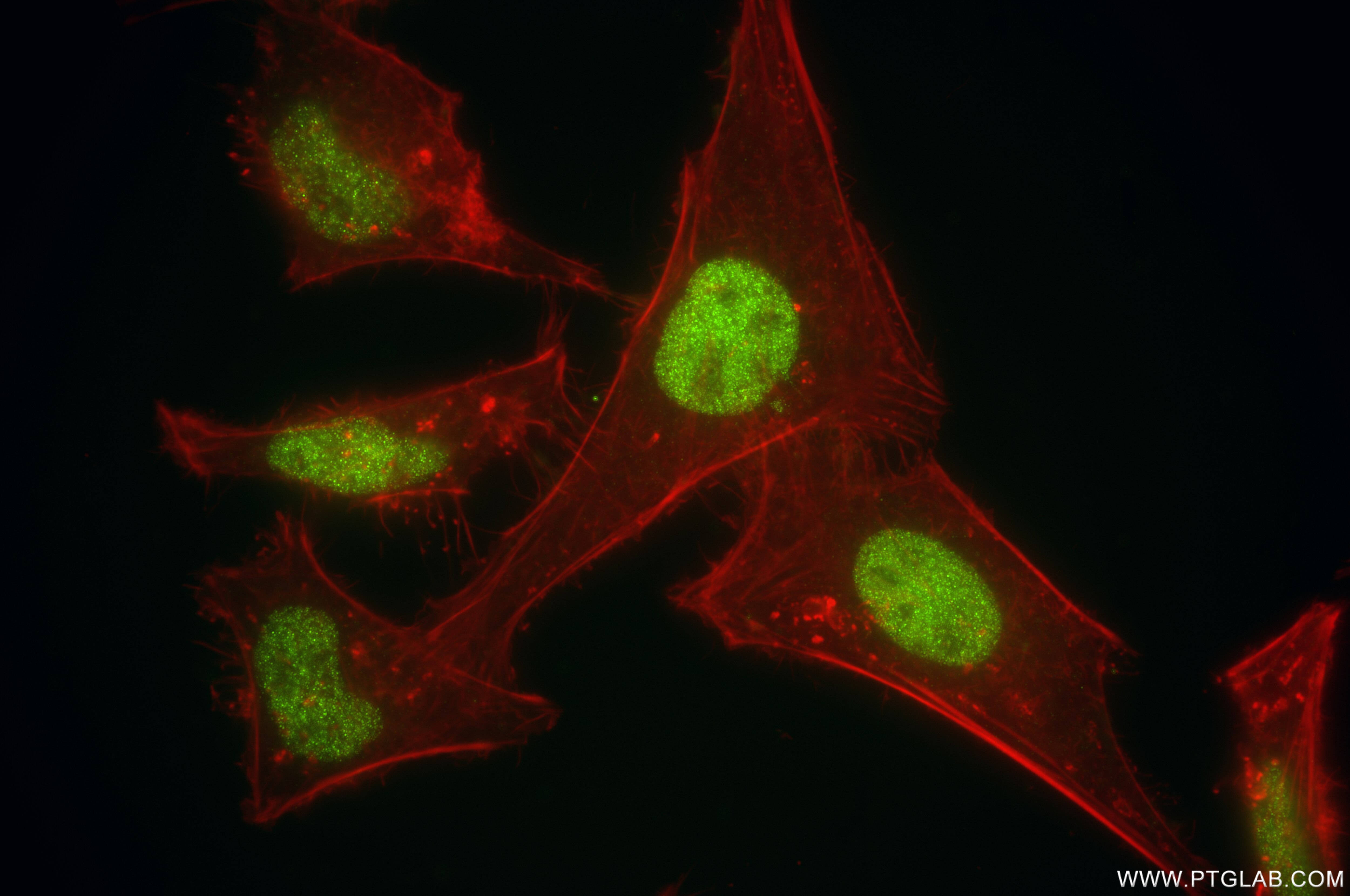 Immunofluorescence (IF) / fluorescent staining of HeLa cells using POLD1 Recombinant antibody (86197-2-RR)