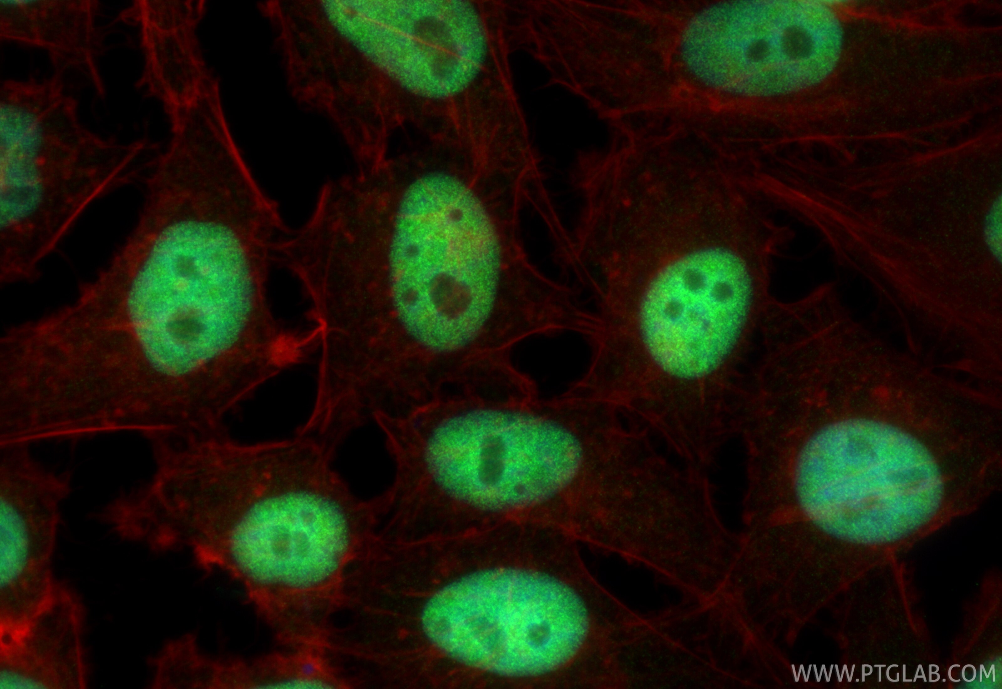 IF Staining of HeLa using RMX00101 Immunofluorescence (IF) / fluorescent staining of HeLa cells using Multi-rAb® POLD1 Multi-Recombinant antibody (RMX00101)