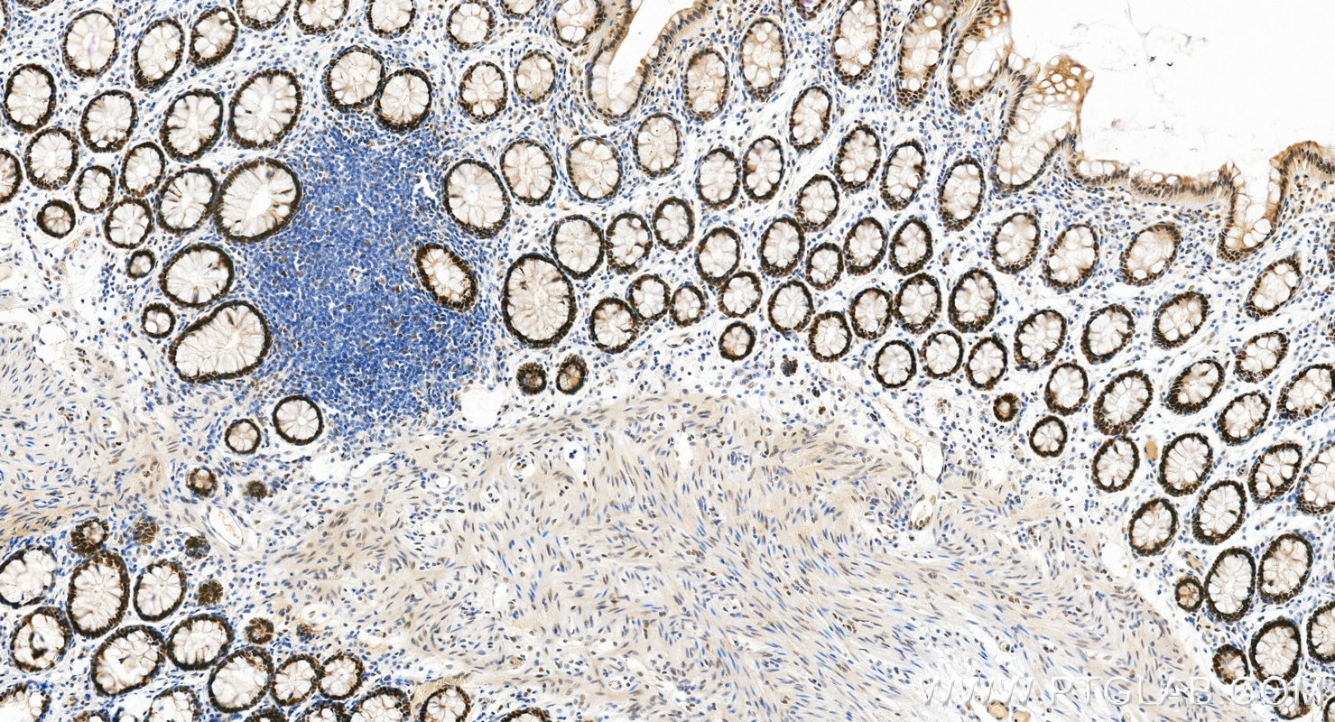 IHC staining of human colon using RMX00101 Immunohistochemistry (IHC) staining of human colon tissue using Multi-rAb® POLD1 Multi-Recombinant antibody (RMX00101)