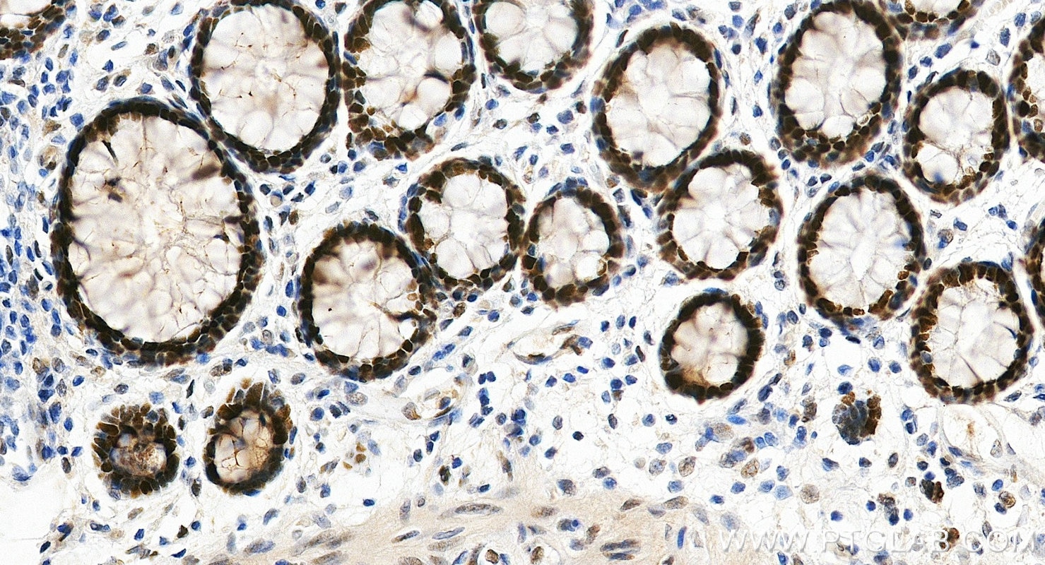 IHC staining of human colon using RMX00101 Immunohistochemistry (IHC) staining of human colon tissue using Multi-rAb® POLD1 Multi-Recombinant antibody (RMX00101)