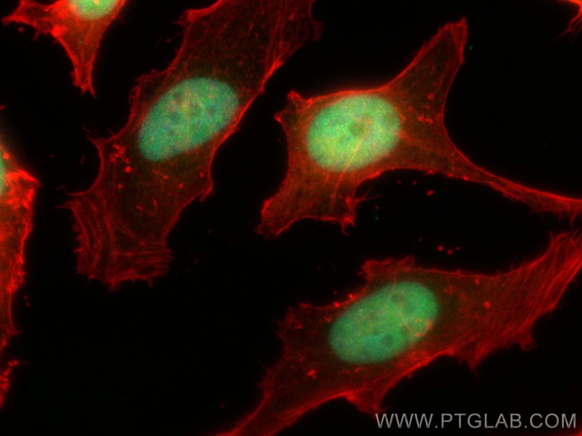 Immunofluorescence (IF) / fluorescent staining of HeLa cells using POLD2 Polyclonal antibody (29765-1-AP)