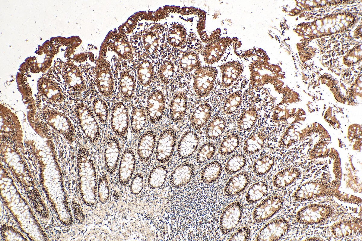 Immunohistochemistry (IHC) staining of human colon tissue using POLD2 Polyclonal antibody (29765-1-AP)