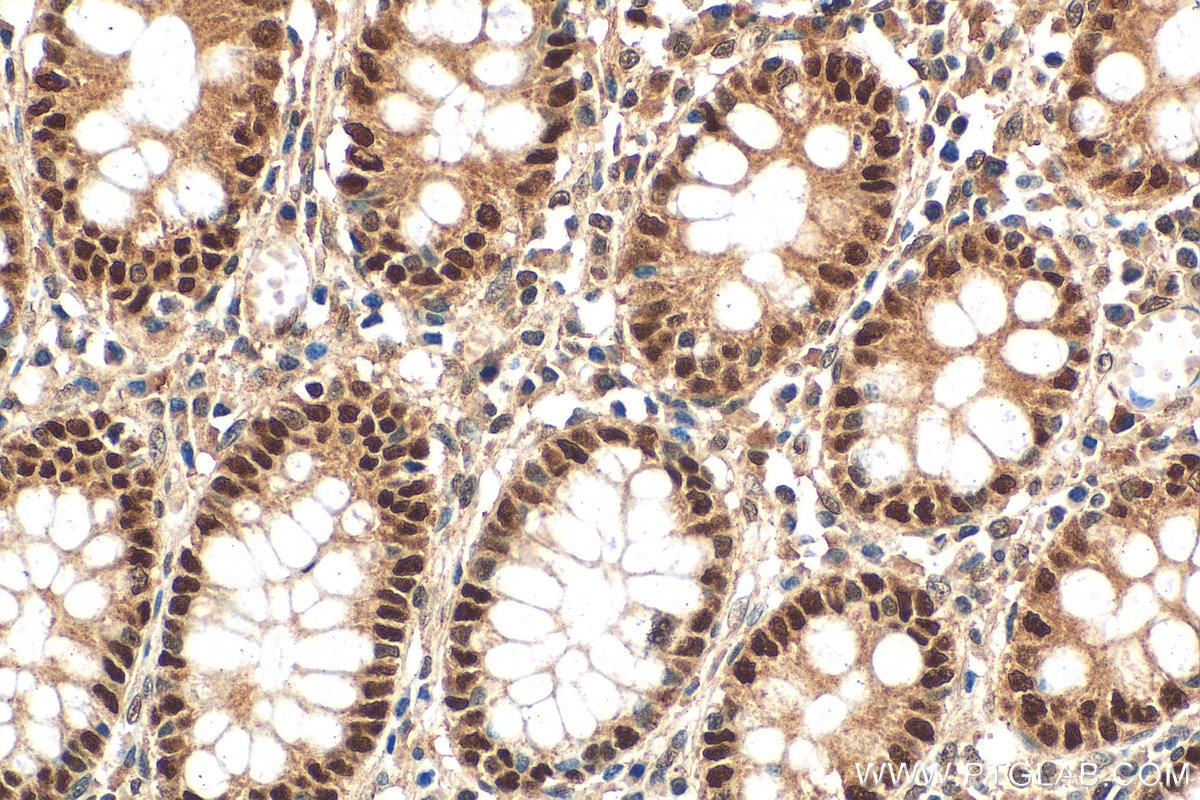 Immunohistochemistry (IHC) staining of human colon tissue using POLD2 Polyclonal antibody (29765-1-AP)
