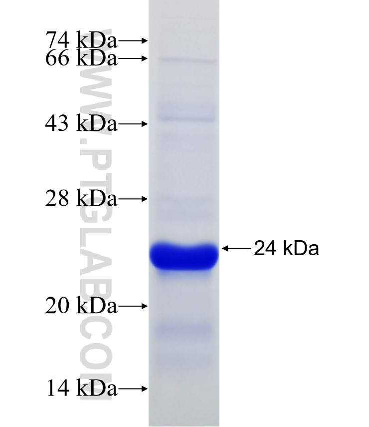 POLD2 fusion protein Ag31521 SDS-PAGE