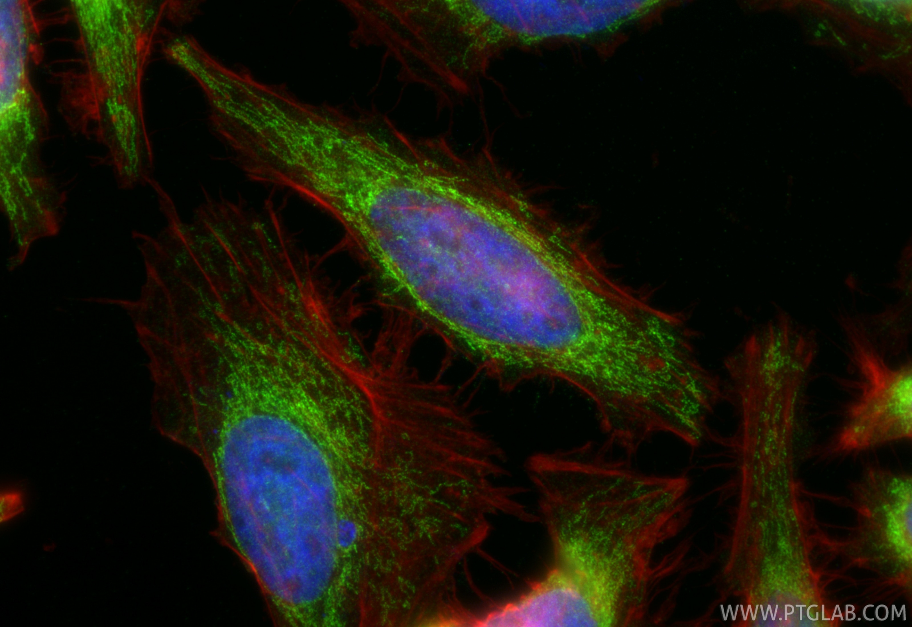 Immunofluorescence (IF) / fluorescent staining of HeLa cells using POLDIP2 Polyclonal antibody (15080-1-AP)