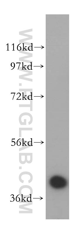 Western Blot (WB) analysis of HeLa cells using POLDIP2 Polyclonal antibody (15080-1-AP)