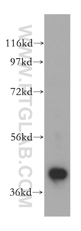 Western Blot (WB) analysis of Jurkat cells using POLDIP2 Polyclonal antibody (15080-1-AP)