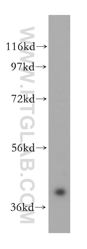 Western Blot (WB) analysis of K-562 cells using POLDIP2 Polyclonal antibody (15080-1-AP)