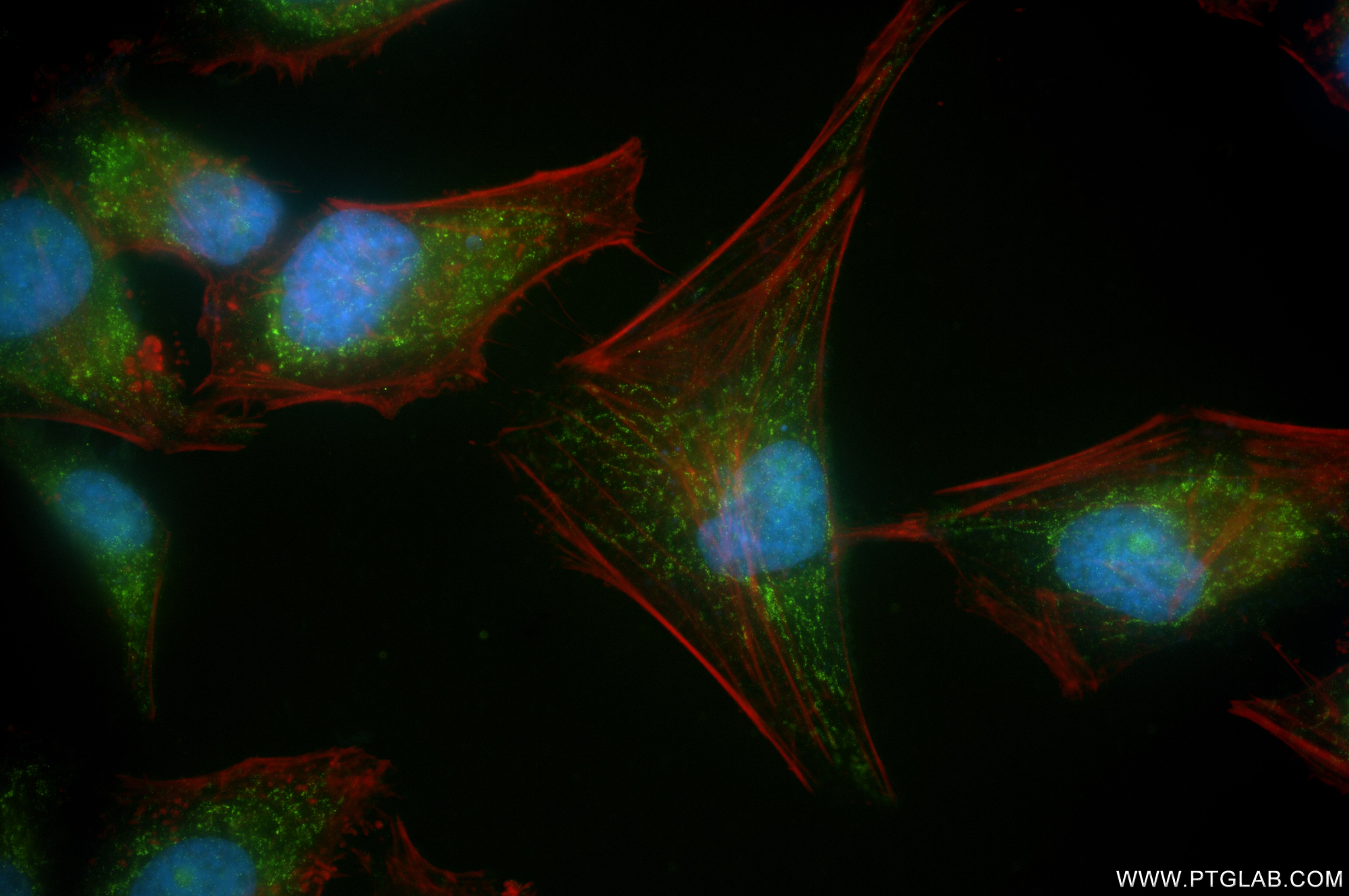 Immunofluorescence (IF) / fluorescent staining of HeLa cells using POLDIP2 Recombinant antibody (86232-3-RR)