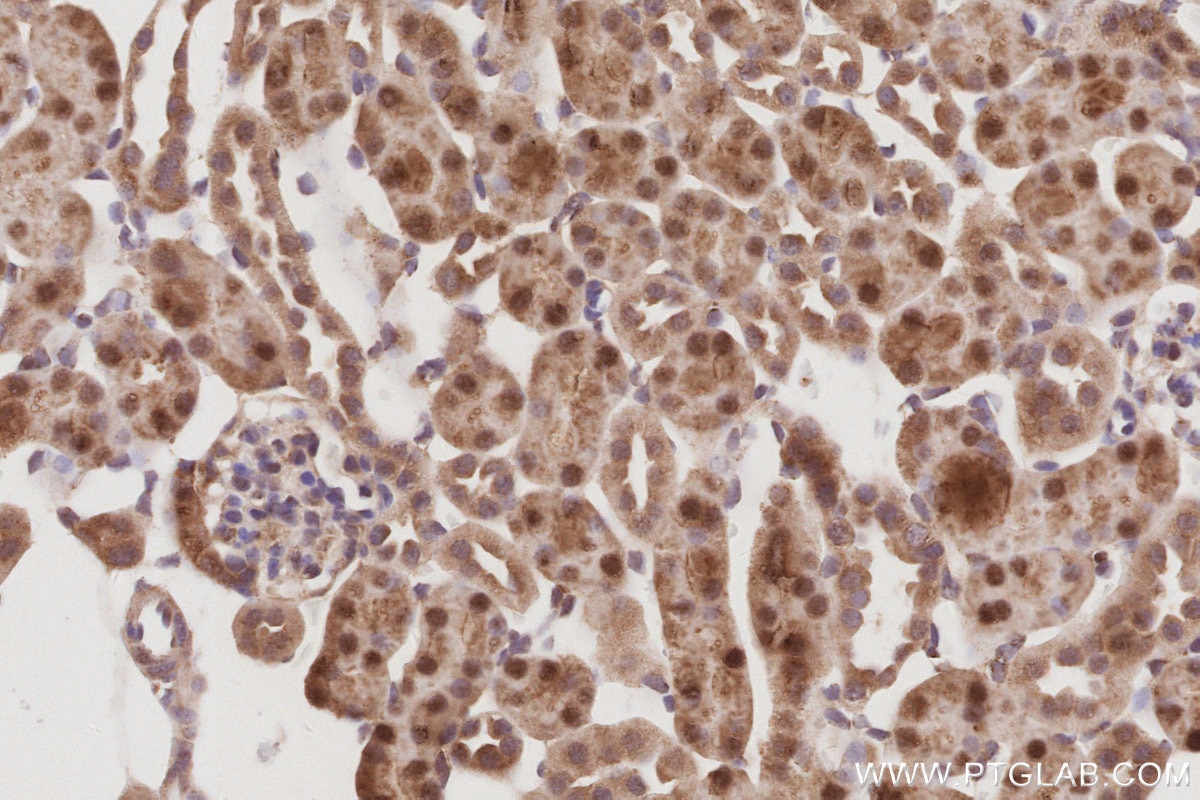 IHC staining of mouse kidney using 86232-3-RR Immunohistochemistry (IHC) staining of mouse kidney tissue using POLDIP2 Recombinant monoclonal antibody (86232-3-RR)