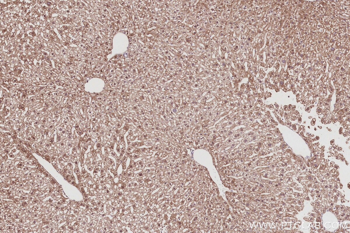 IHC staining of mouse liver using 86232-3-RR Immunohistochemistry (IHC) staining of mouse liver tissue using POLDIP2 Recombinant monoclonal antibody (86232-3-RR)