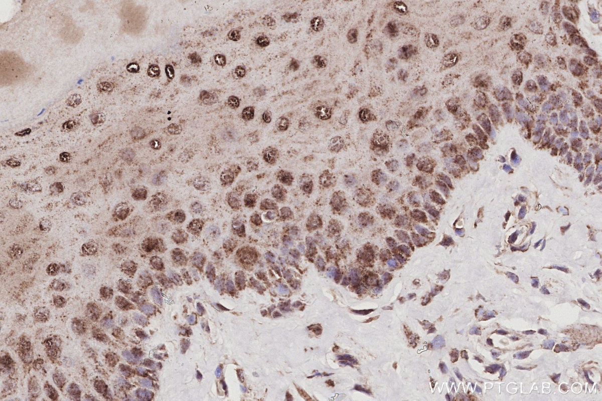 IHC staining of rat tongue using 86232-3-RR Immunohistochemistry (IHC) staining of rat tongue tissue using POLDIP2 Recombinant monoclonal antibody (86232-3-RR)