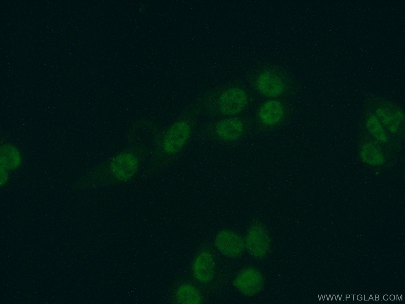 Immunofluorescence (IF) / fluorescent staining of HeLa cells using SKAR Polyclonal antibody (17466-1-AP)