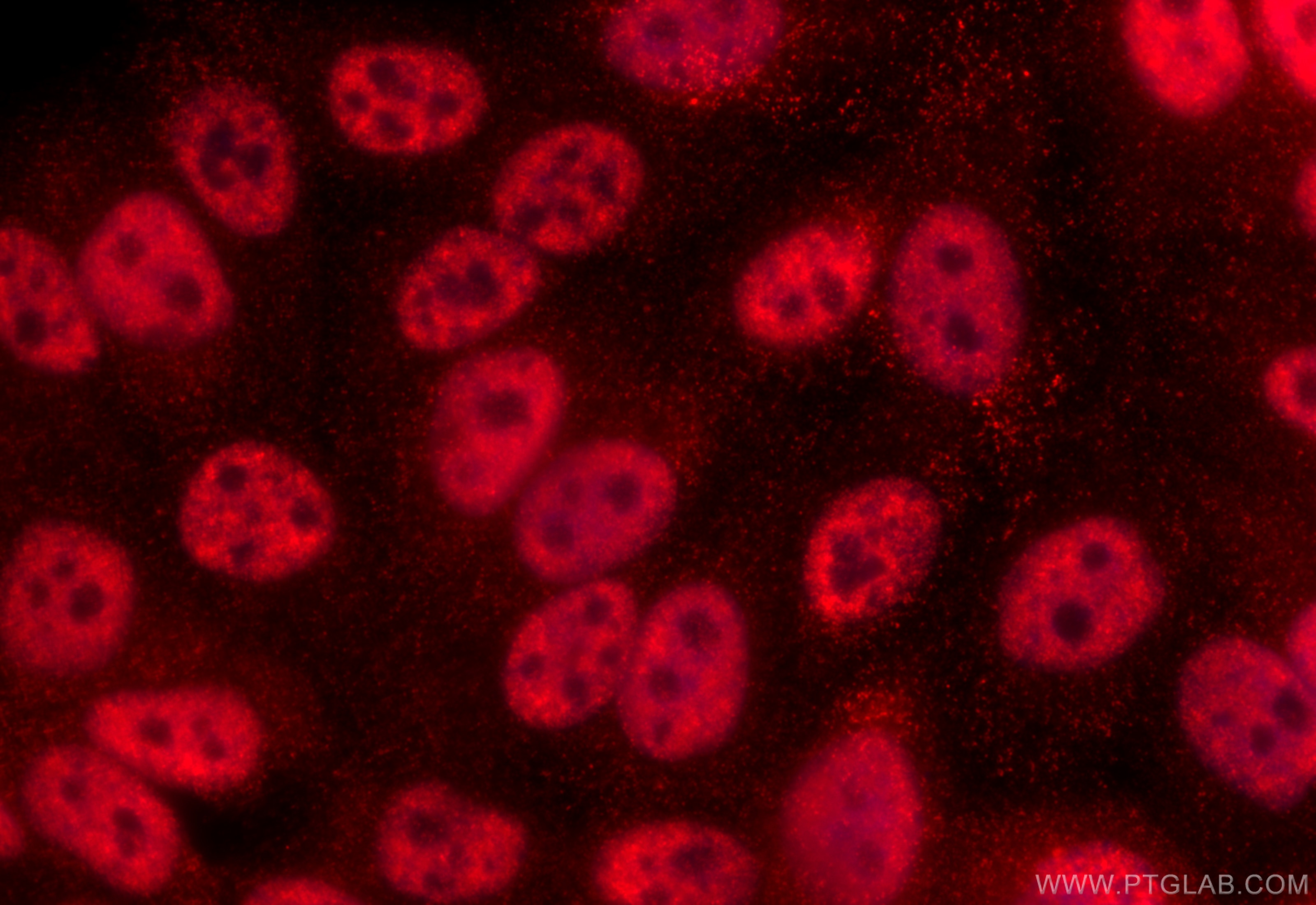 Immunofluorescence (IF) / fluorescent staining of HepG2 cells using SKAR Polyclonal antibody (17466-1-AP)