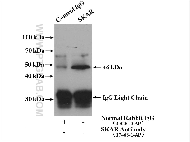 Immunoprecipitation (IP) experiment of mouse brain tissue using SKAR Polyclonal antibody (17466-1-AP)