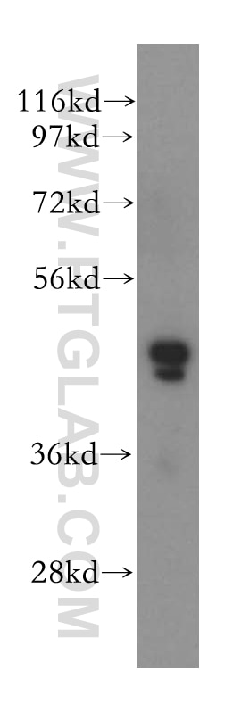 Western Blot (WB) analysis of HeLa cells using SKAR Polyclonal antibody (17466-1-AP)