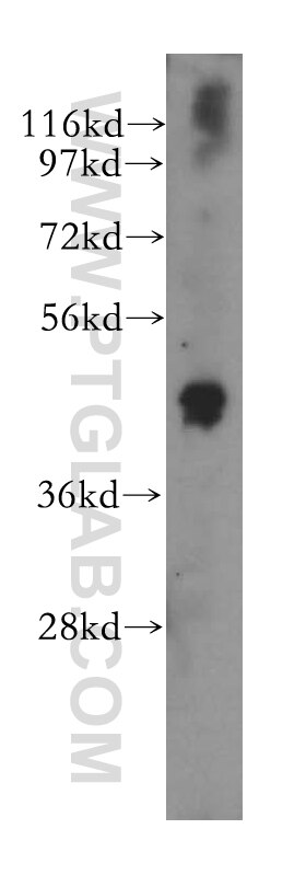 Western Blot (WB) analysis of A549 cells using SKAR Polyclonal antibody (17466-1-AP)