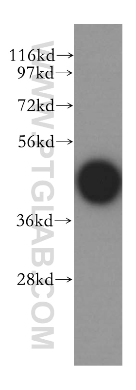 Western Blot (WB) analysis of HepG2 cells using SKAR Polyclonal antibody (17466-1-AP)