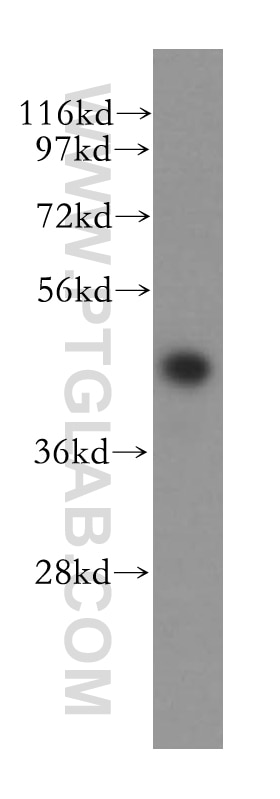 Western Blot (WB) analysis of mouse brain tissue using SKAR Polyclonal antibody (17466-1-AP)