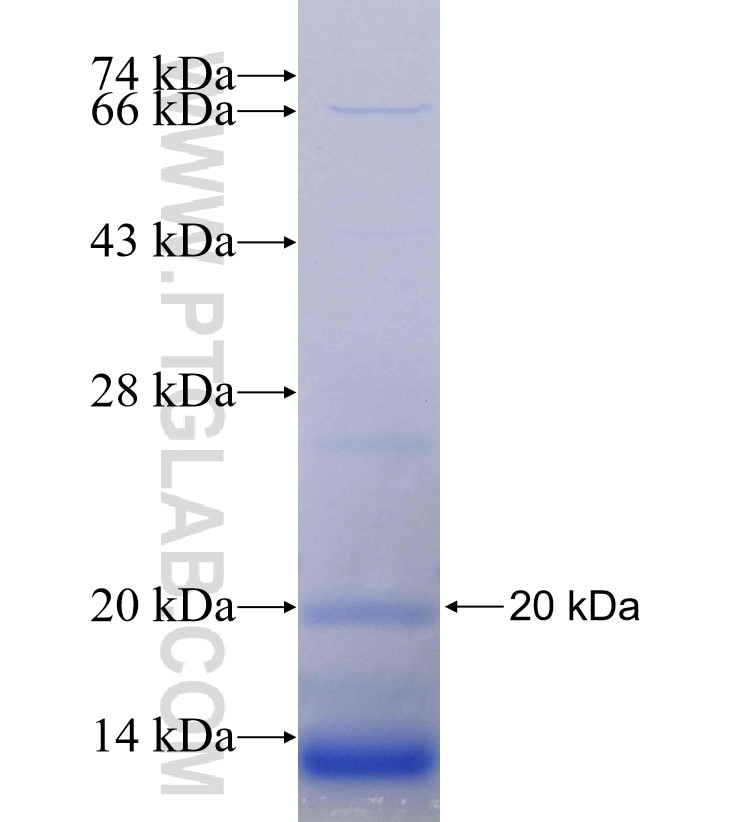 POLE fusion protein Ag30055 SDS-PAGE POLE fusion protein Ag30055 SDS-PAGE