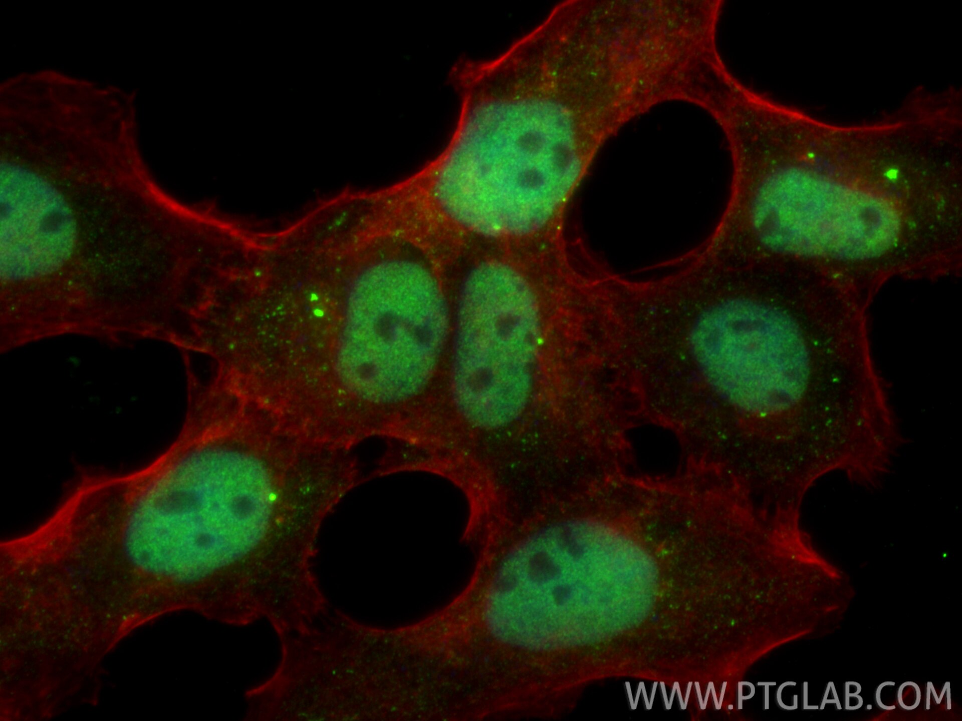 Immunofluorescence (IF) / fluorescent staining of A431 cells using POLE2 Polyclonal antibody (33482-1-AP)