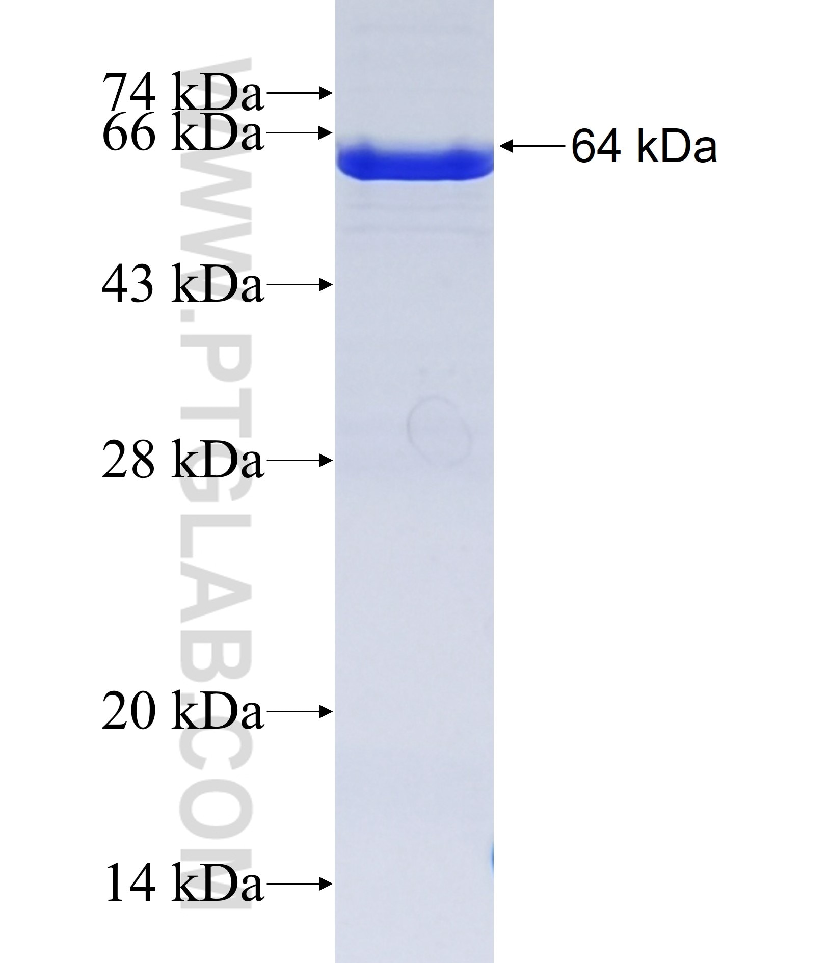 POLE2 fusion protein Ag38070 SDS-PAGE POLE2 fusion protein Ag38070 SDS-PAGE