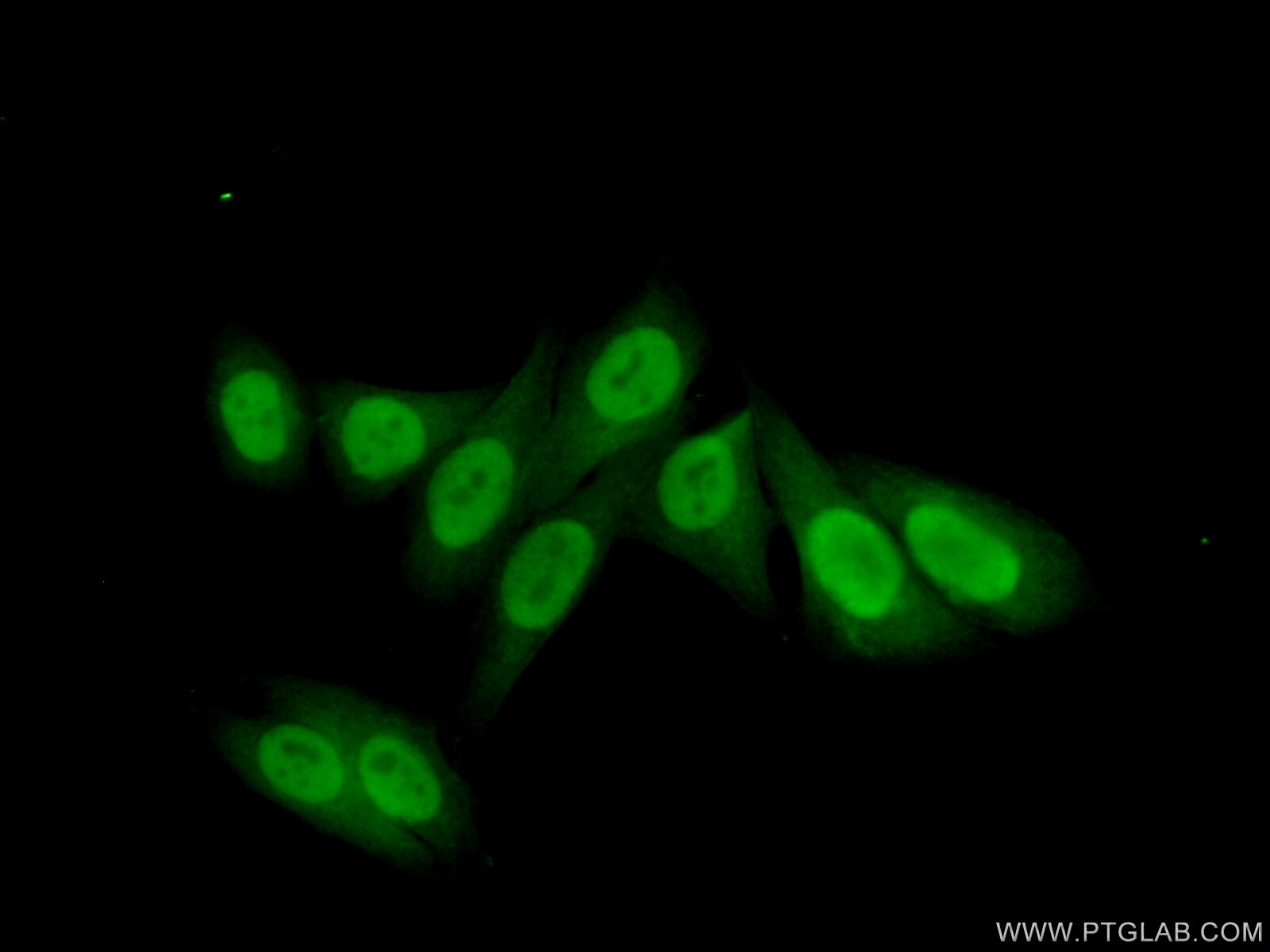 IF Staining of HepG2 using 15278-1-AP