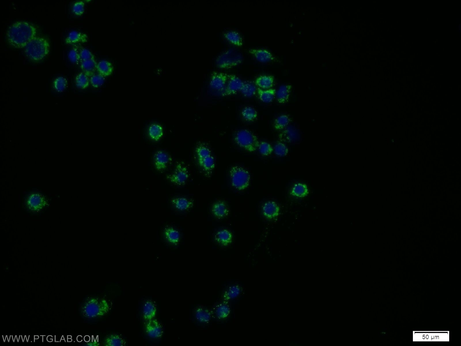 Immunofluorescence (IF) / fluorescent staining of COLO 320 cells using POLG2 Polyclonal antibody (10997-2-AP)