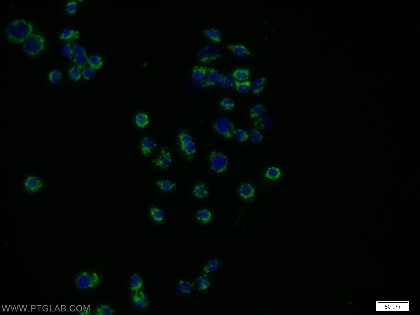 IF Staining of COLO 320 using 10997-2-AP